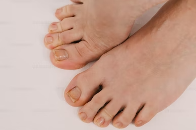Diabetic Foot Pain 