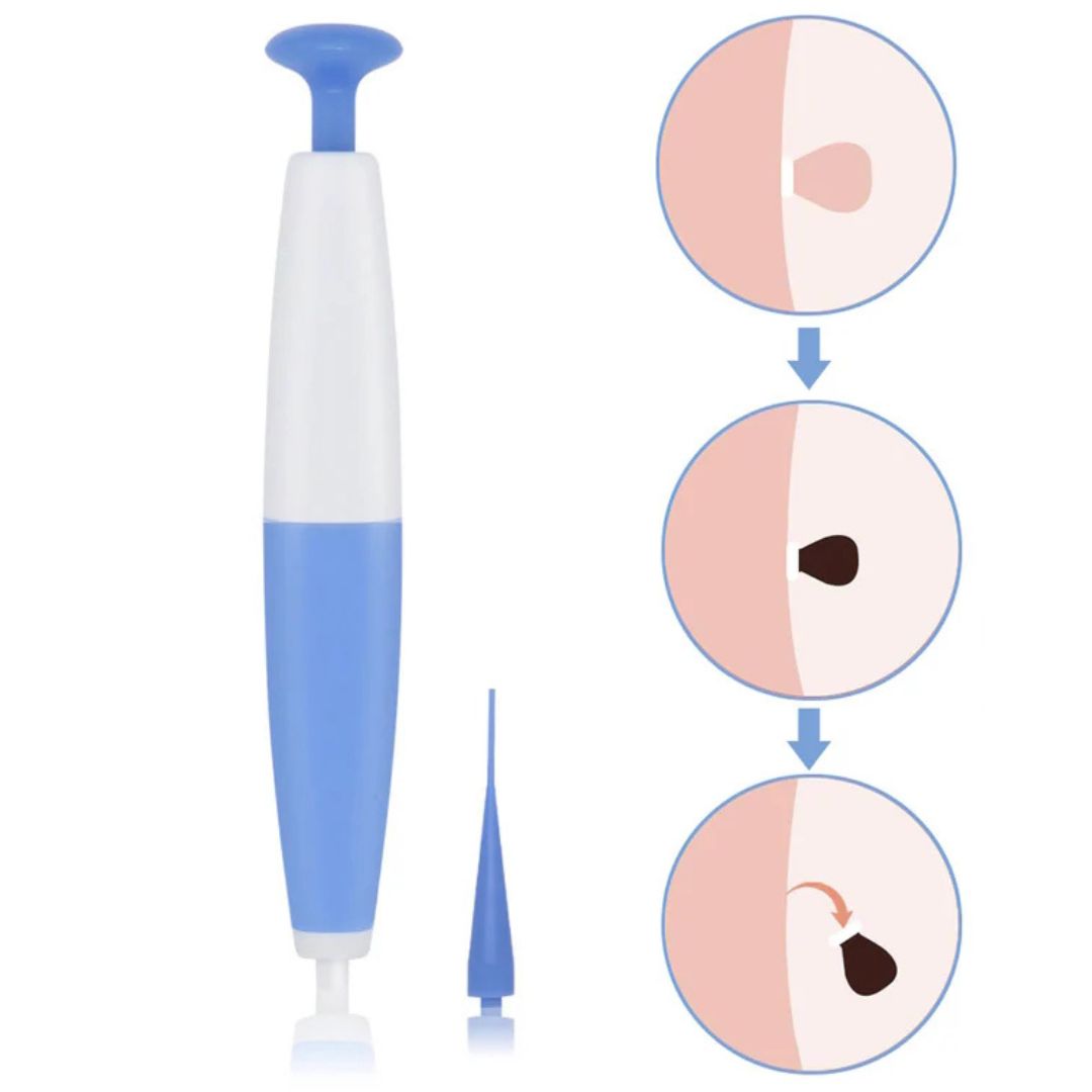 TagLift - Gentle Skin Tag Removal Kit