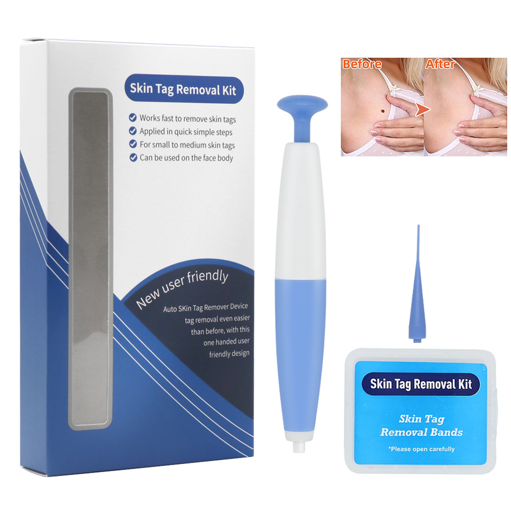TagLift - Gentle Skin Tag Removal Kit