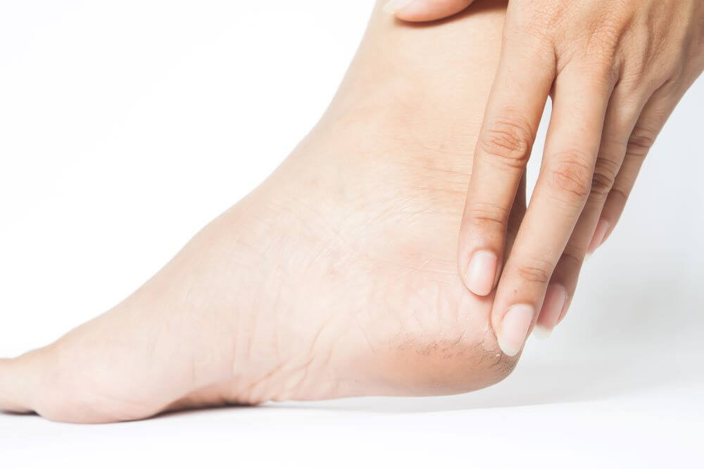 How To Get Pretty Feet