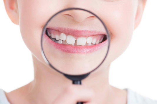 What Causes Crooked Teeth and How to Treat Them