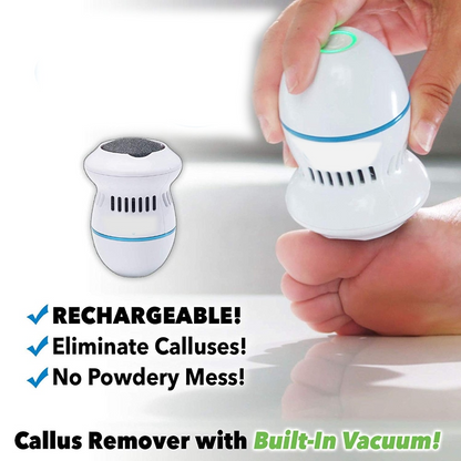 Electronic Pedicure Foot File And Callus Remover