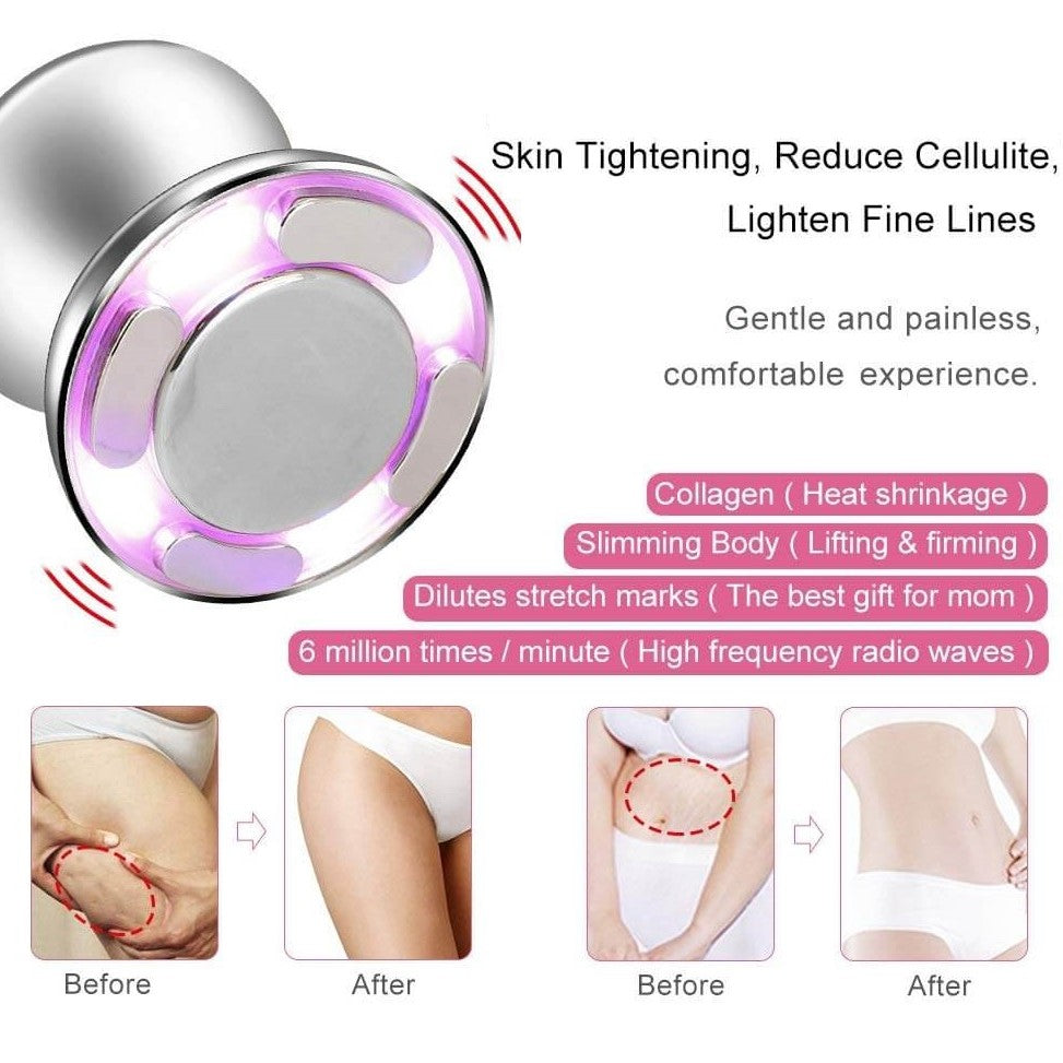 Vacuum Therapy For Belly Fat