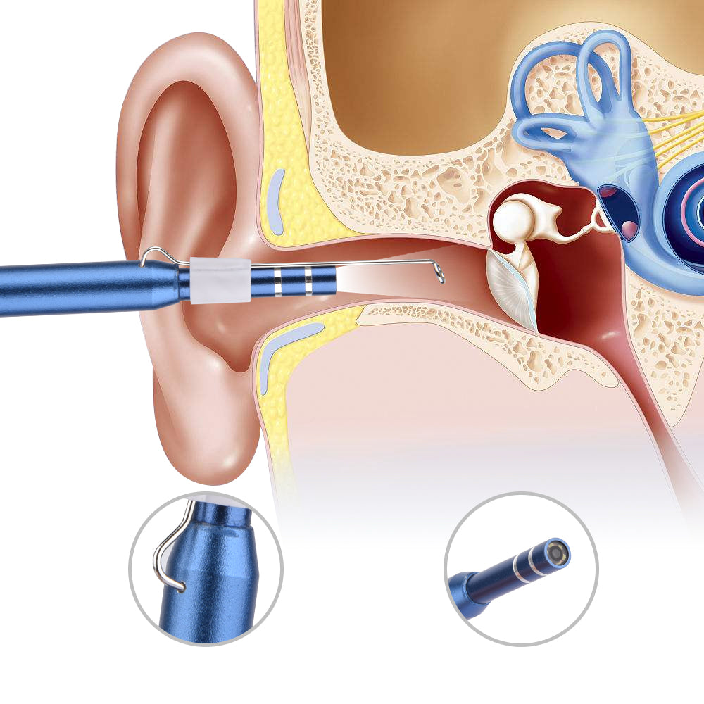Camera Earwax Removal Kit