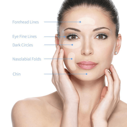 Microneedling With Hyaluronic Acid