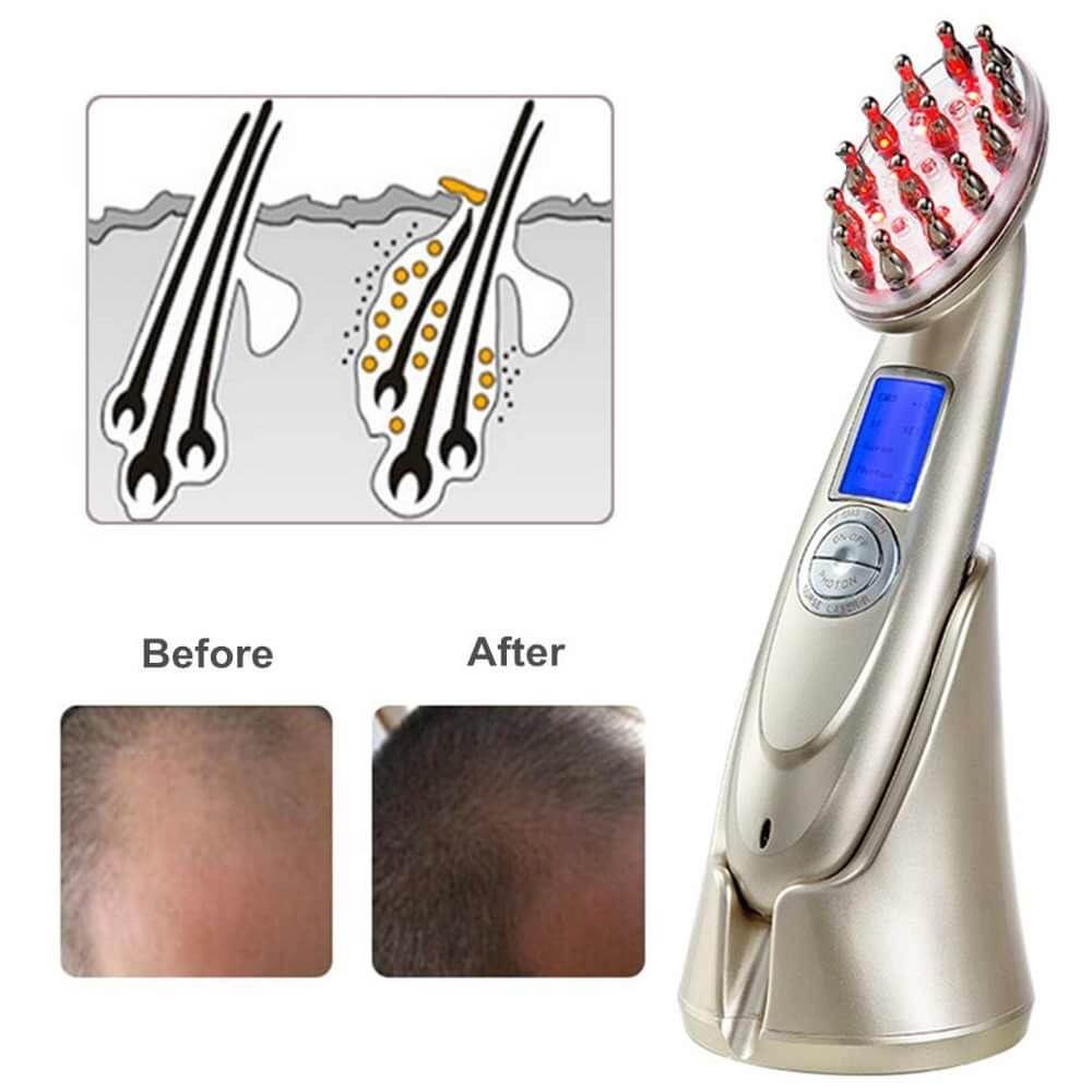 Best Laser Comb For Hair Loss