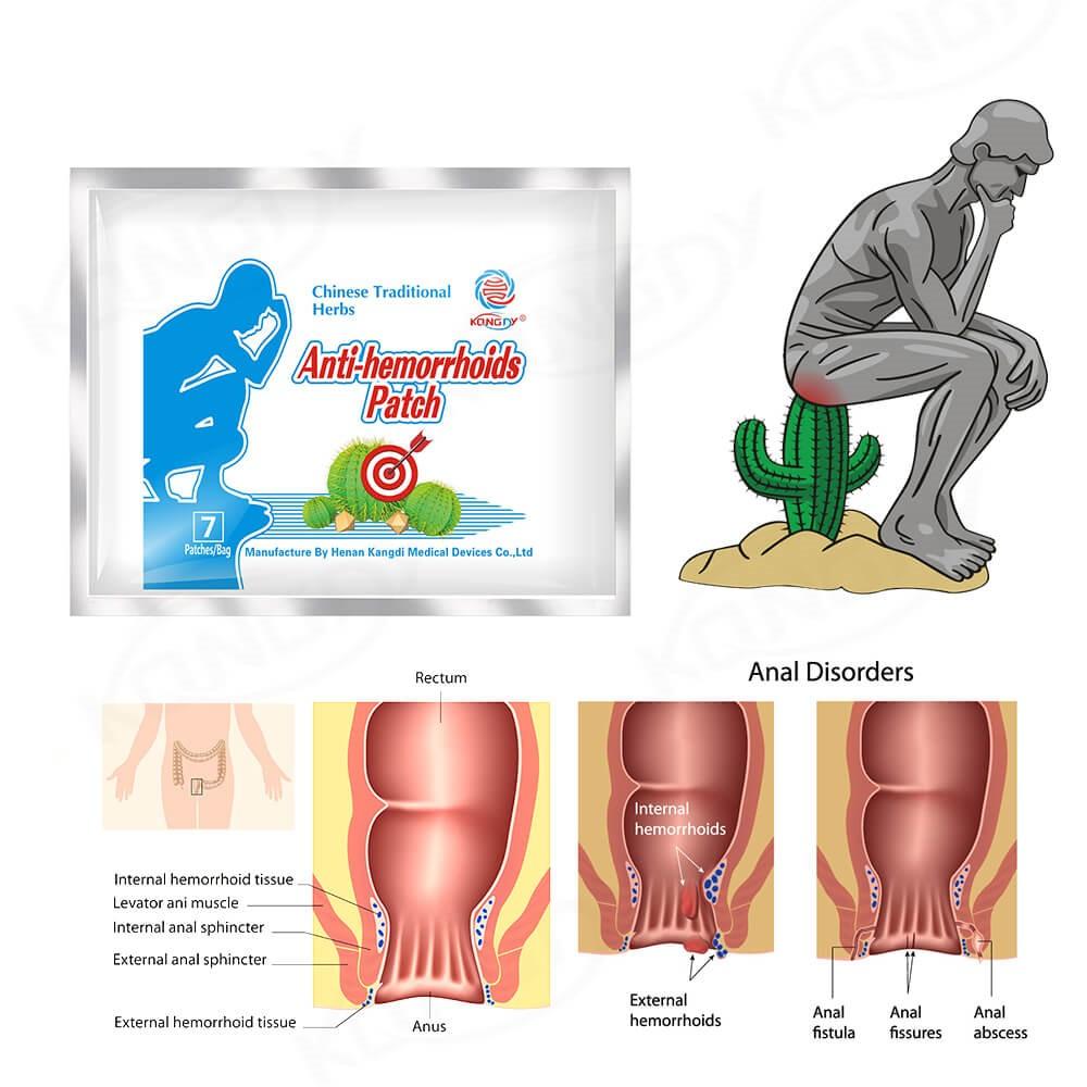 hemorrhoids patch solutions