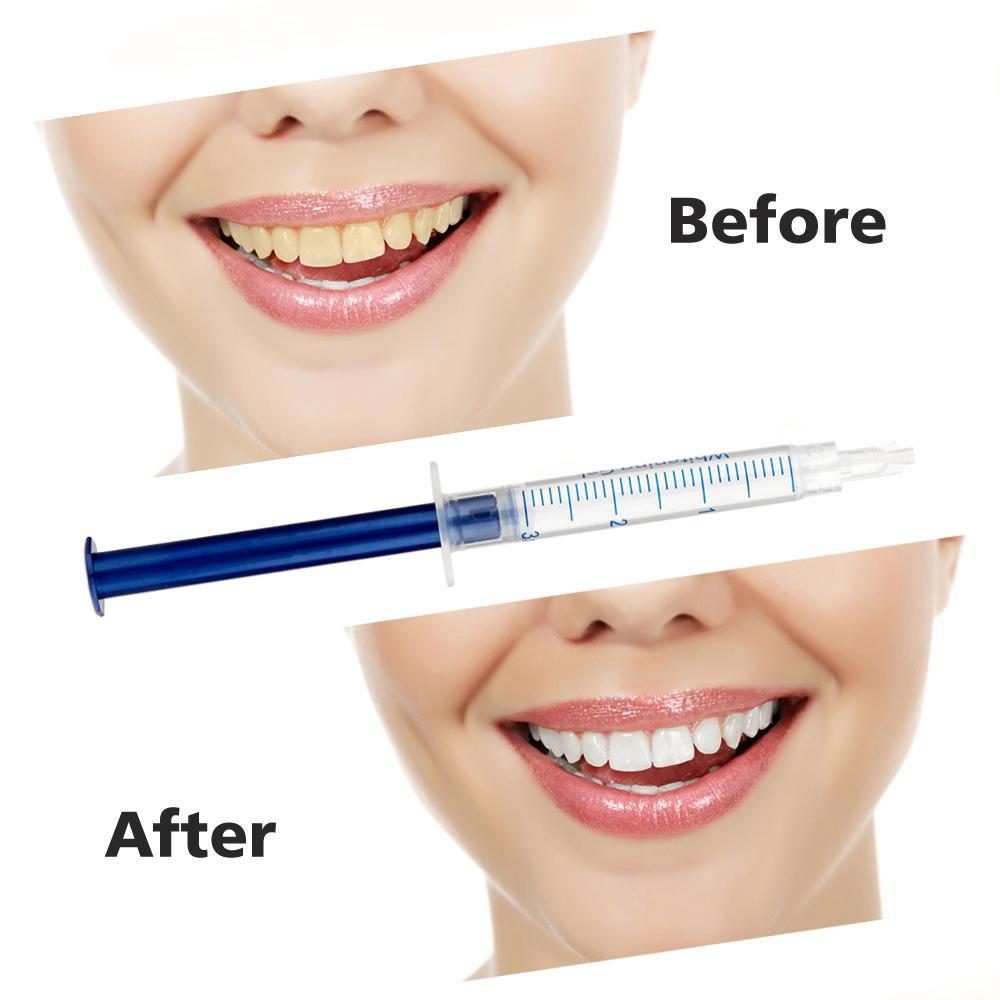 How To Whiten Teeth Fast