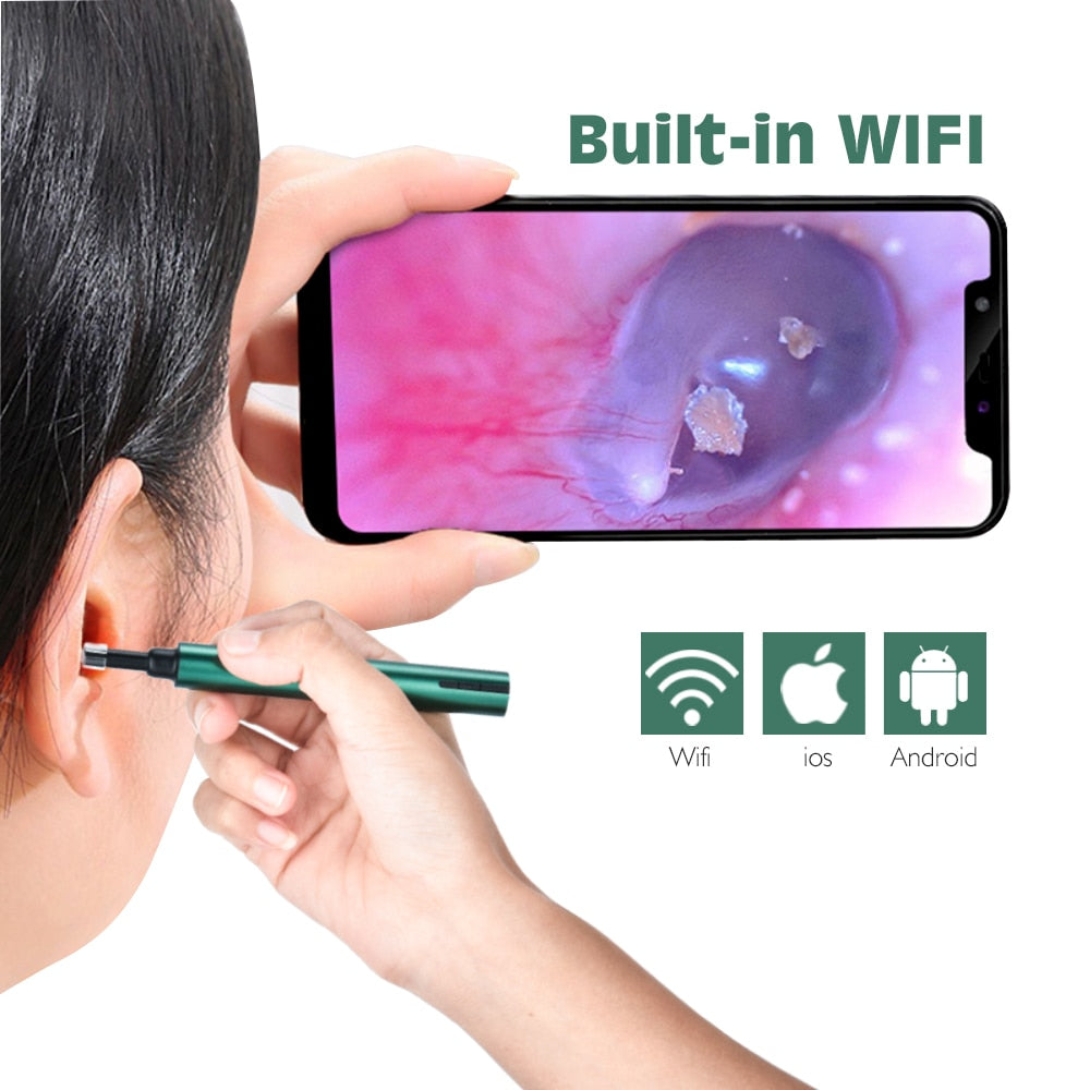 Ear Endoscope Camera