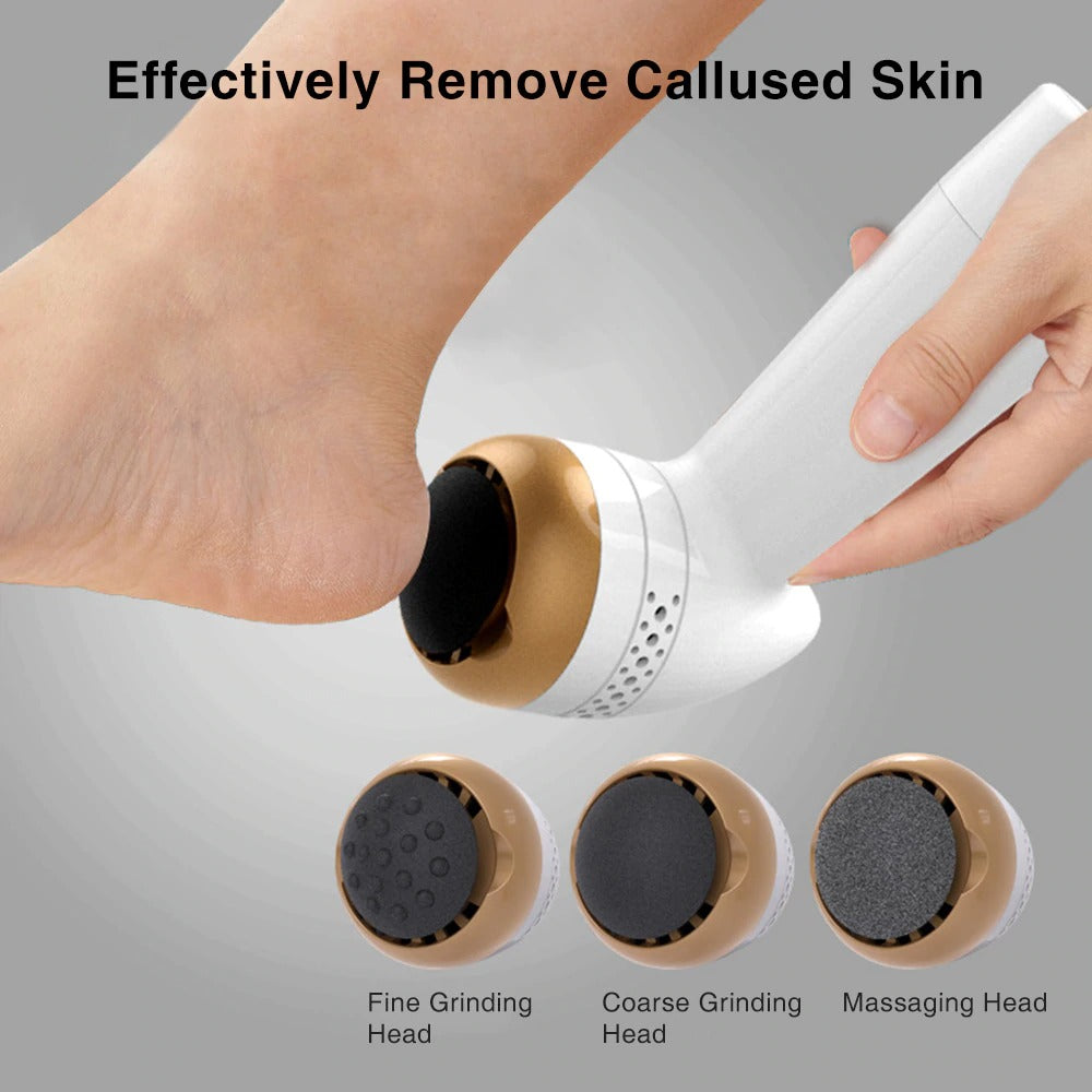 How To Remove Callus From Hands