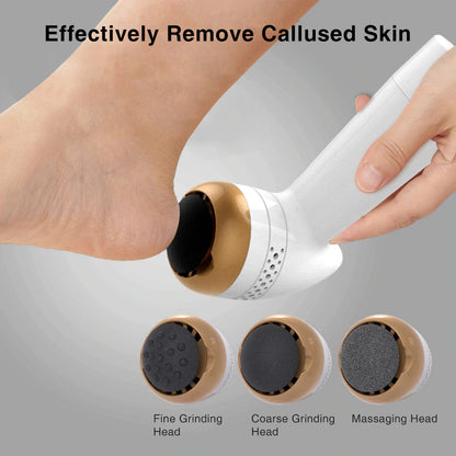 How To Remove Callus From Hands