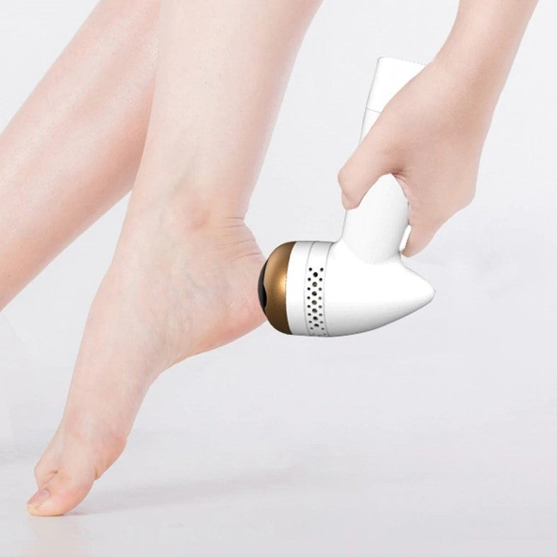 How To Remove Calluses From Feet Permanently