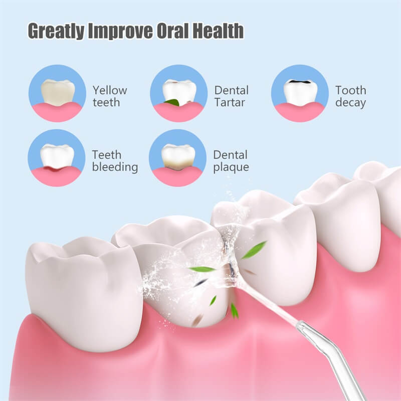 Is Water Flossing Effective