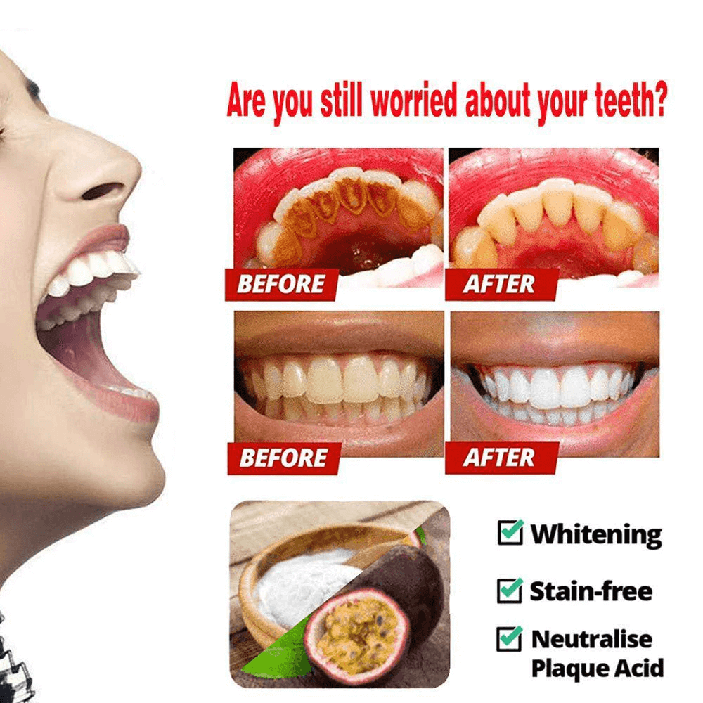 What Is The Best Whitening Toothpaste